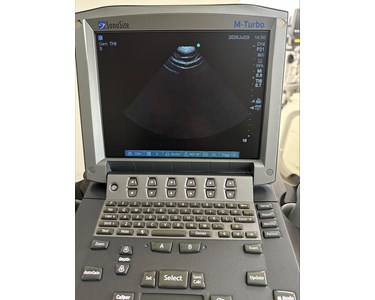 Sonosite - SonoSite M-Turbo Ultrasound EX3467