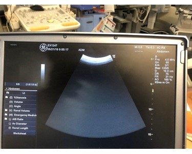 GE - Logiq e portable ultrasound machine