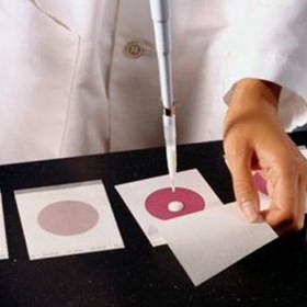 Bacteria Testing Plates | Petrifilm