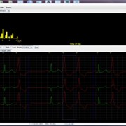 Holter Monitor | myPatch-SL