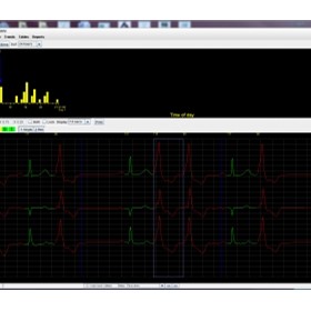 Holter Analysis Software | Holter LX - Enhanced Plus