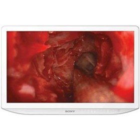 HD Surgical Monitors | LMD-2765MD & LMD-2760MD