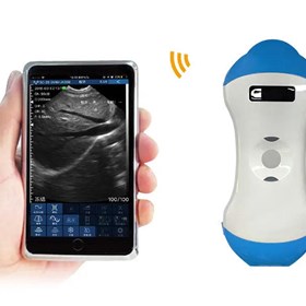 Wireless 5ML 2-in-1 Palm Doppler Ultrasound Scanner