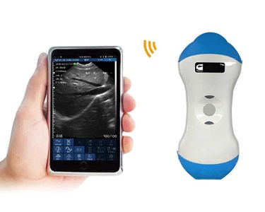 Wireless 5ML 2-in-1 Palm Doppler Ultrasound Scanner