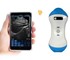 Wireless 5ML 2-in-1 Palm Doppler Ultrasound Scanner