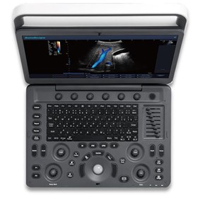 E2 Portable Color Doppler Ultrasound System