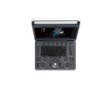 SonoScape - E2 Portable Color Doppler Ultrasound System