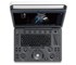 SonoScape - E2 Portable Color Doppler Ultrasound System