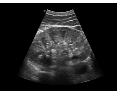 SonoScape - E2 Portable Color Doppler Ultrasound System