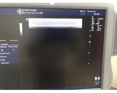 GE - Ultrasound Machine | Logiq 9 BT_07