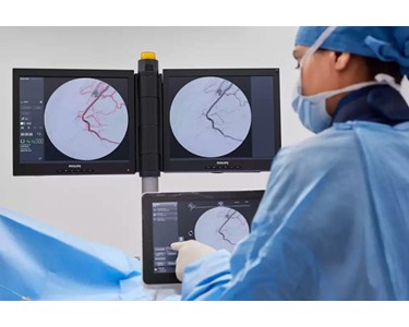 Philips - Motorised Mobile C-Arm with Flat Detector | Zenition 90