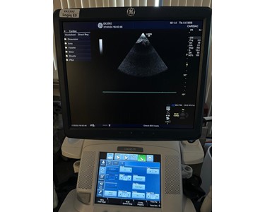 GE - GE Logiq E9 | Ultrasound Machine | EX3592