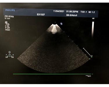 Philips - S8-3 - [Array Transducer] [EX2600] 