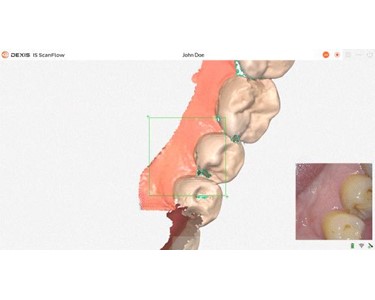 Dexis - Imprevo Intraoral Scanner