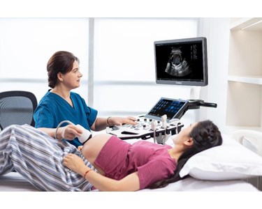 Vinno - Cart-Based Ultrasound | VINNO S300 