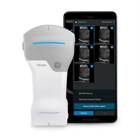 Wireless Handheld Ultrasound Scanner Vscan Air™