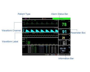 Multi-Parameter Veterinary Monitor | PM6000V