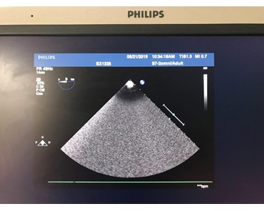 Philips - S7-2 omni | TEE Transducer | EX1229