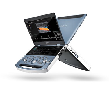 Mindray - General Imaging Portable Ultrasound System | MX7