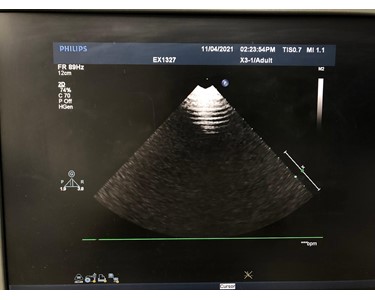 Philips -  X3-1 [Ultrasound Transducer] [EX2603]