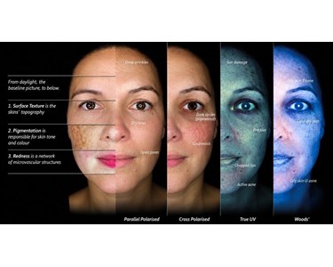 Pre-owned OBSERV 520 Professional Skin Analysis & Consultation System