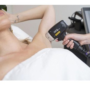 Choosing the Best Laser Machine for Laser Hair Removal: Your Ultimate Guide