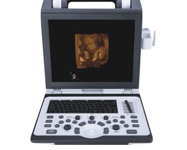 Apogee - Portable Ultrasound Machine | Apogee 2100 Entry Level Colour Doppler