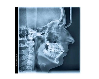 2D Panoramic X ray System | ProVecta S-Pan