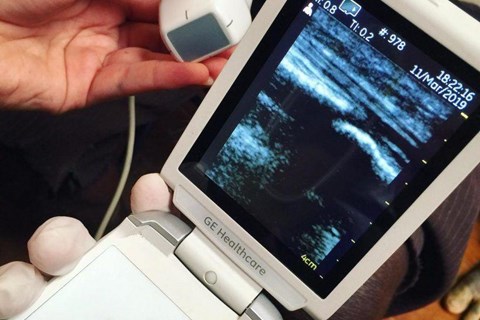 Expanding access to health care in Papua New Guinea with handheld ultrasound