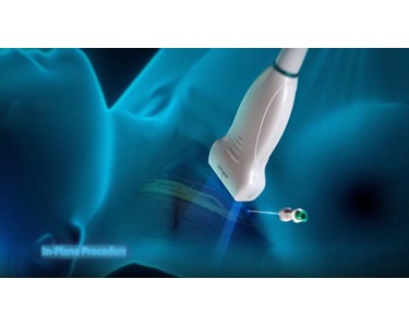 Mindray - Point of Care Ultrasound System | TE7