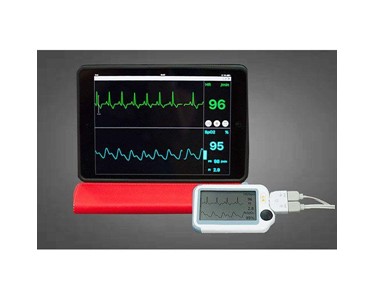 Sentier - Veterinary Vital Signs Monitor | Sentier Vetcorder™ Classic