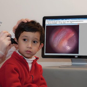 Wireless HD Digital Video Otoscope for ENT and Audiology
