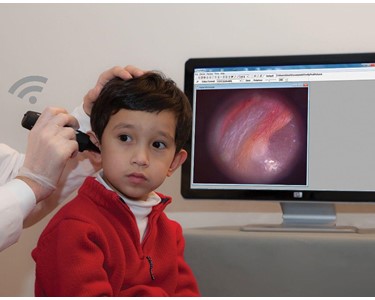Firefly - Wireless HD Digital Video Otoscope for ENT and Audiology