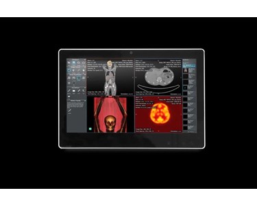 Onyx - 15.6" Fanless Slim Medical All In One PC | SMA-1533