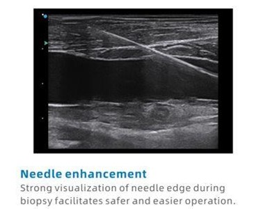 SIUI - Apogee 2100 Plus Digital Color Doppler Ultrasound Imaging System
