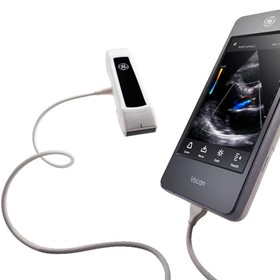 Handheld Ultrasound Scanner | Vscan Extend