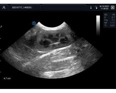 Imex - Hand Held Ultrasound | VP2 