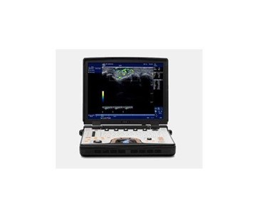 GE Healthcare - Ultrasound System | NextGen LOGIQe