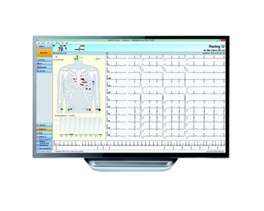 Amedtec - ECGpro CardioPart 12 PC-Based ECG 12 Channel