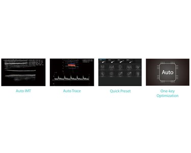 SonoScape - P9 Trolley Color Doppler Ultrasound System