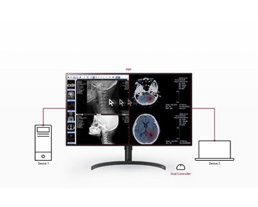 LG - Diagnostic Monitor | 31.5" 8MP | 32HL512D-B | Medical Monitor