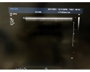 Philips - L17-5 | Linear Transducer | EX2567