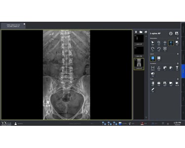 Universal Chiropractic Radiographic System