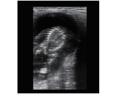 BMV - Bovine Veterinary Ultrasound 28th Day Pregnancy Detection -Bestscan S5