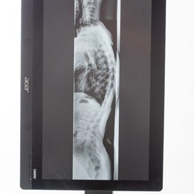Full Spine DR Panel Longtail