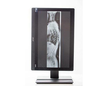 Full Spine DR Panel Longtail