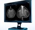 Sectra -  2D Imaging Systems I Breast Imaging PACS and RIS