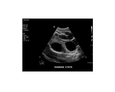 Philips - ClearVue Ultrasound System