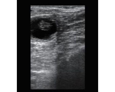 BMV - Bovine Veterinary Ultrasound 28th Day Pregnancy Detection -Bestscan S5