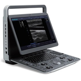 E1 Portable Ultrasound Scanner